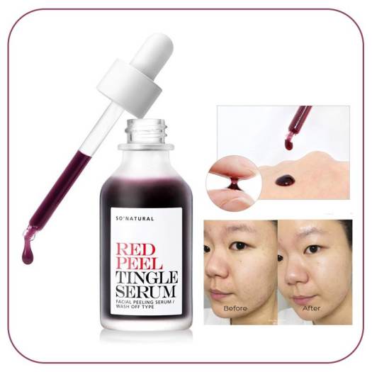 [so natural] Red Peel Tingle Serum 35ml [US, Japan, Germany, India, UK, Uae, France, Italy, Brazil, Canada, Russia, South Africa, Australia, Kuwait, Mexico, Indonesia, Netherlands, Saudi Arabia, UKRAIN, Finland, POLAND, Singapore, Malaysia ]