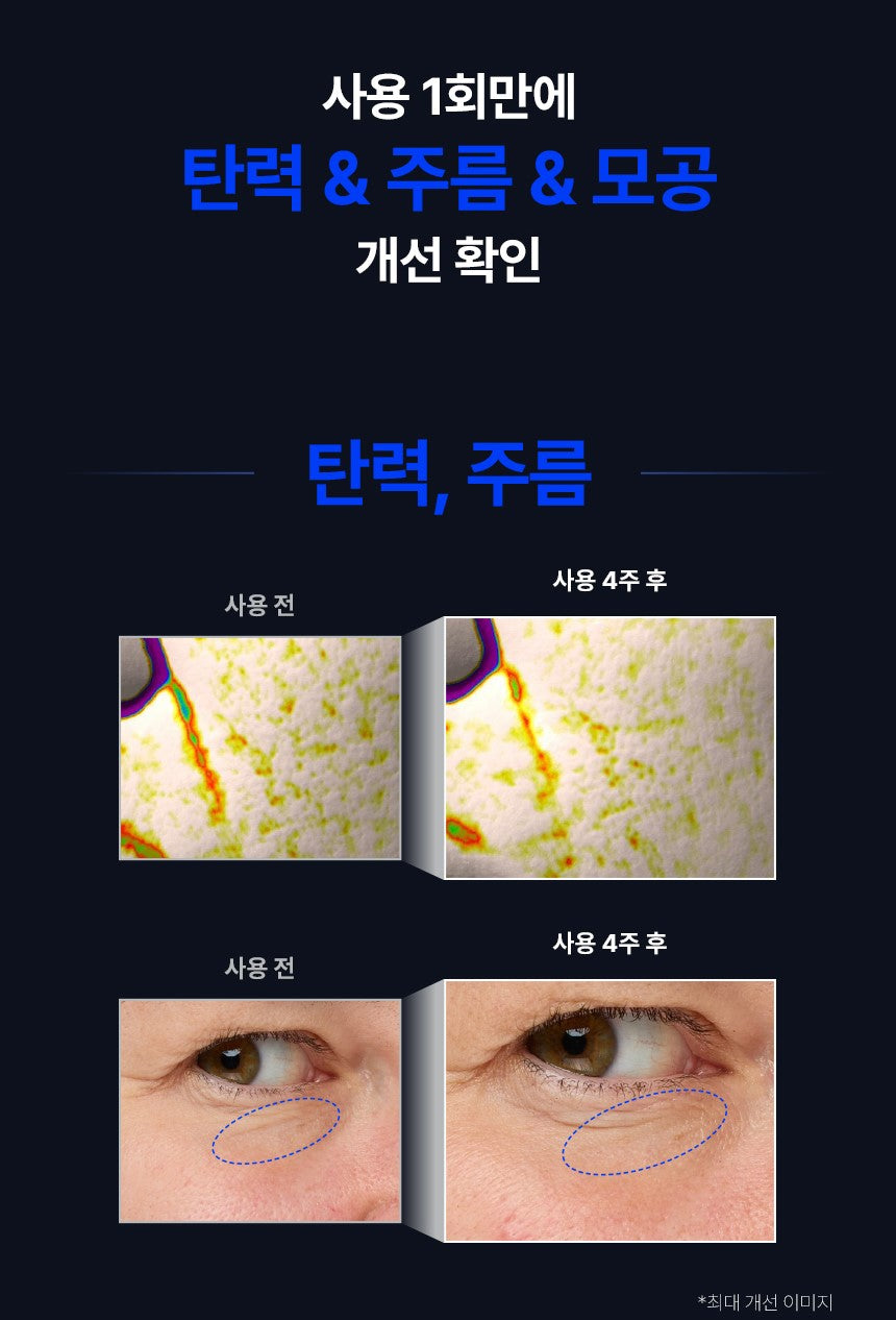 (NEW) IOPE Retinol Reti-Jection Serum 2% 50ml [US, Japan, Germany, India, UK, Uae, France, Italy, Brazil, Canada, Russia, South Africa, Australia, Kuwait, Mexico, Indonesia, Netherlands, Saudi Arabia, UKRAIN, Finland, POLAND, Singapore, Malaysia ]