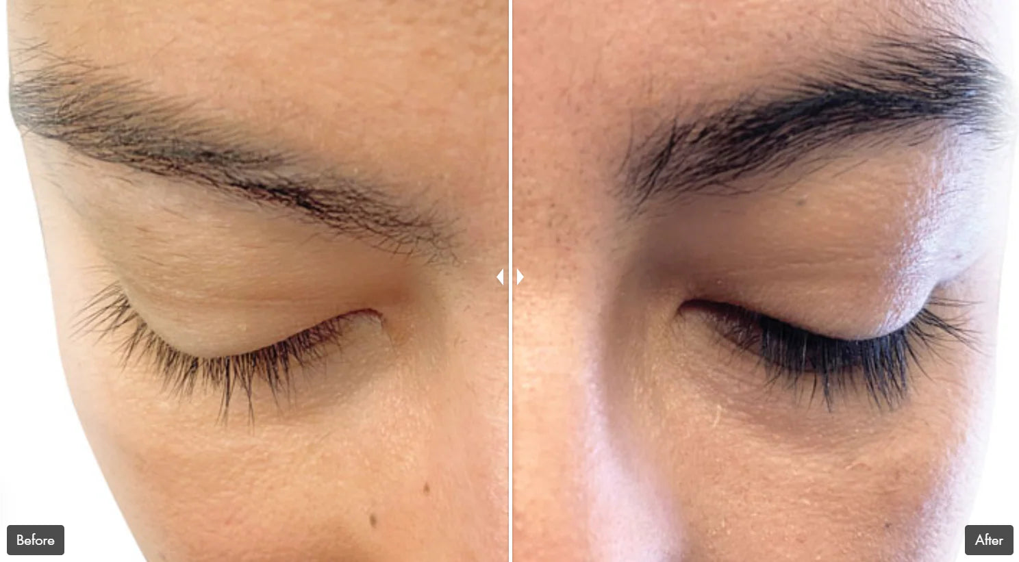 REJURAN Advanced Lash Inhancing Booster 3ml [US, Japan, Germany, India, UK, Uae, France, Italy, Brazil, Canada, Russia, South Africa, Australia, Kuwait, Mexico, Indonesia, Netherlands, Saudi Arabia, UKRAIN, Finland, POLAND, Singapore, Malaysia ]