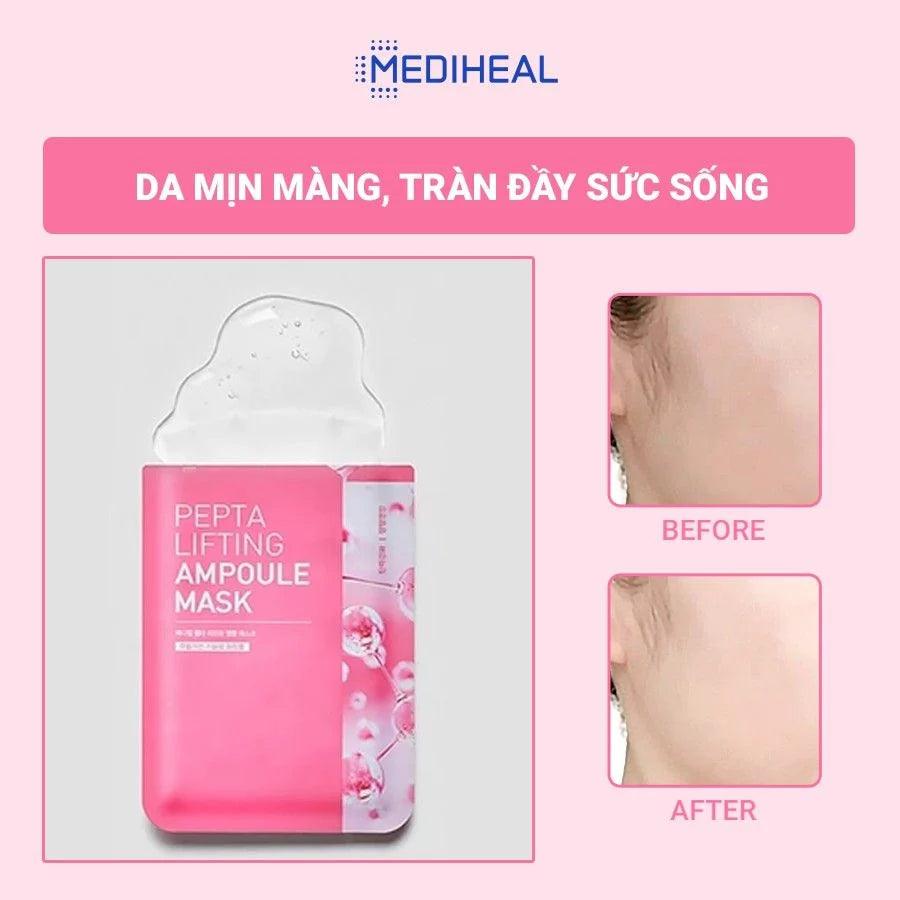 MEDIHEAL Pepta Lifting Ampoule MASK SHEET 20ml X 15pcs (Copy) - KimYoung K-beauty Shop