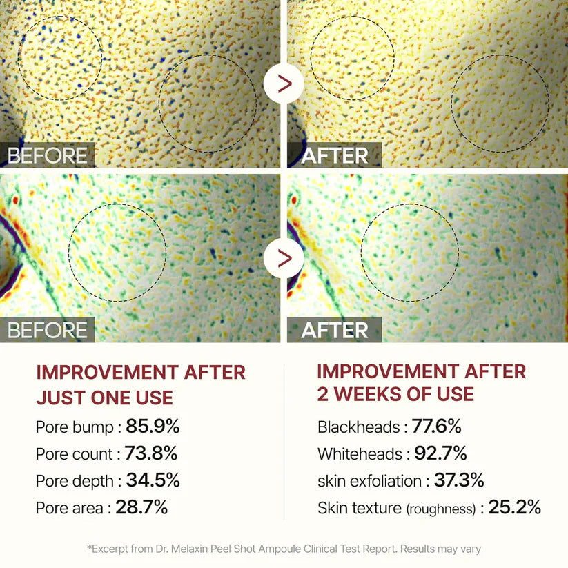 Dr. Melaxin PEEL SHOT™ 80mL [US, Japan, Germany, India, UK, Uae, France, Italy, Brazil, Canada, Russia, South Africa, Australia, Kuwait, Mexico, Indonesia, Netherlands, Saudi Arabia, UKRAIN, Finland, POLAND, Singapore, Malaysia ]