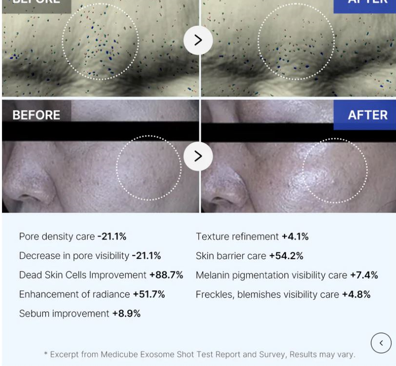 medicube Zero Exosome Shot 30ml (2000/7500) [US, Japan, Germany, India, UK, Uae, France, Italy, Brazil, Canada, Russia, South Africa, Australia, Kuwait, Mexico, Indonesia, Netherlands, Saudi Arabia, UKRAIN, Finland, POLAND, Singapore, Malaysia ]